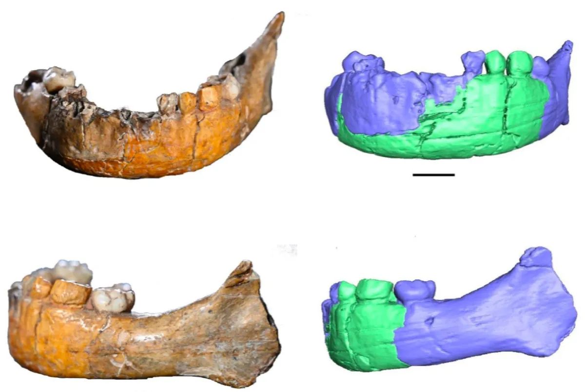 Mandíbula y estructura dental